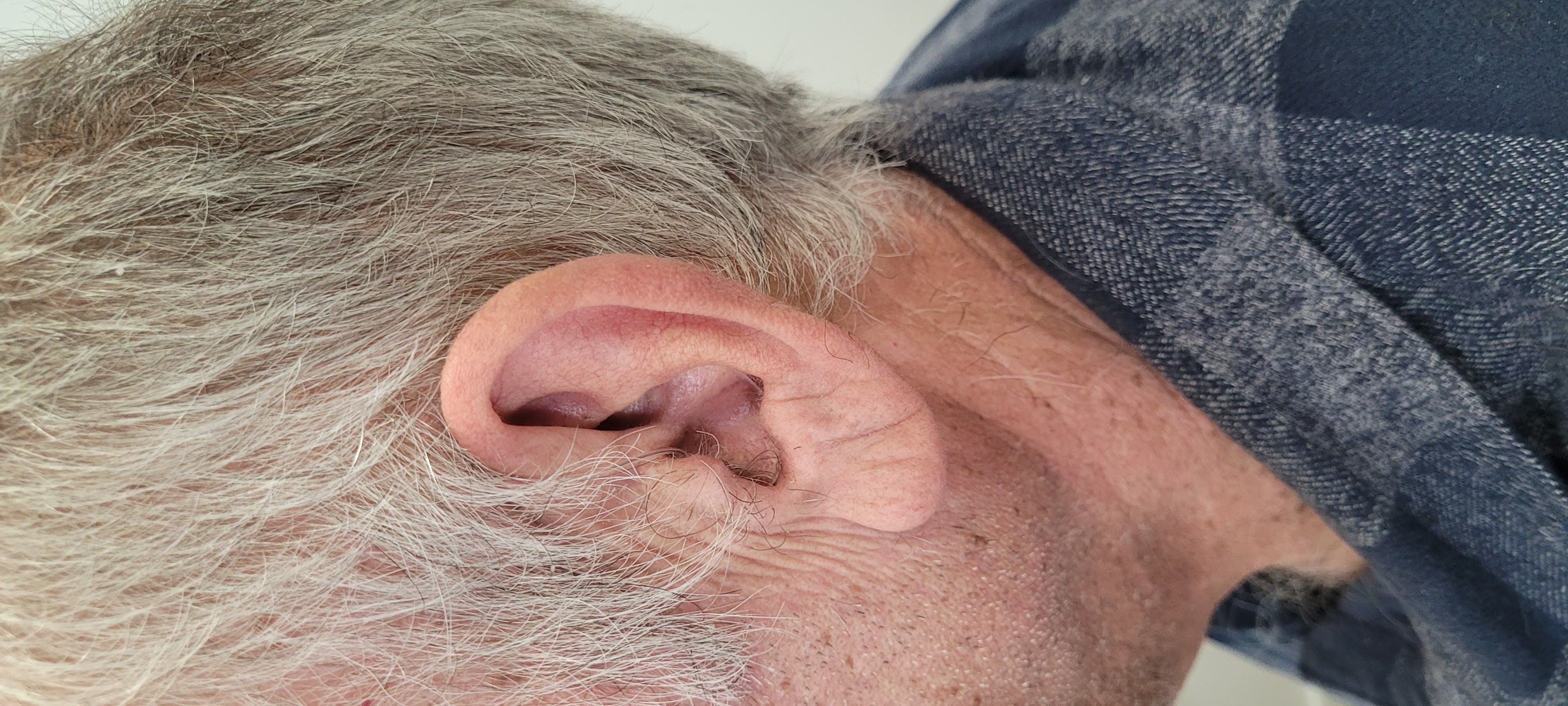 Création Exemple rite mini contour d'oreille visible chez L'AUDIOPROTHESISTE DIMITRI SECONDE