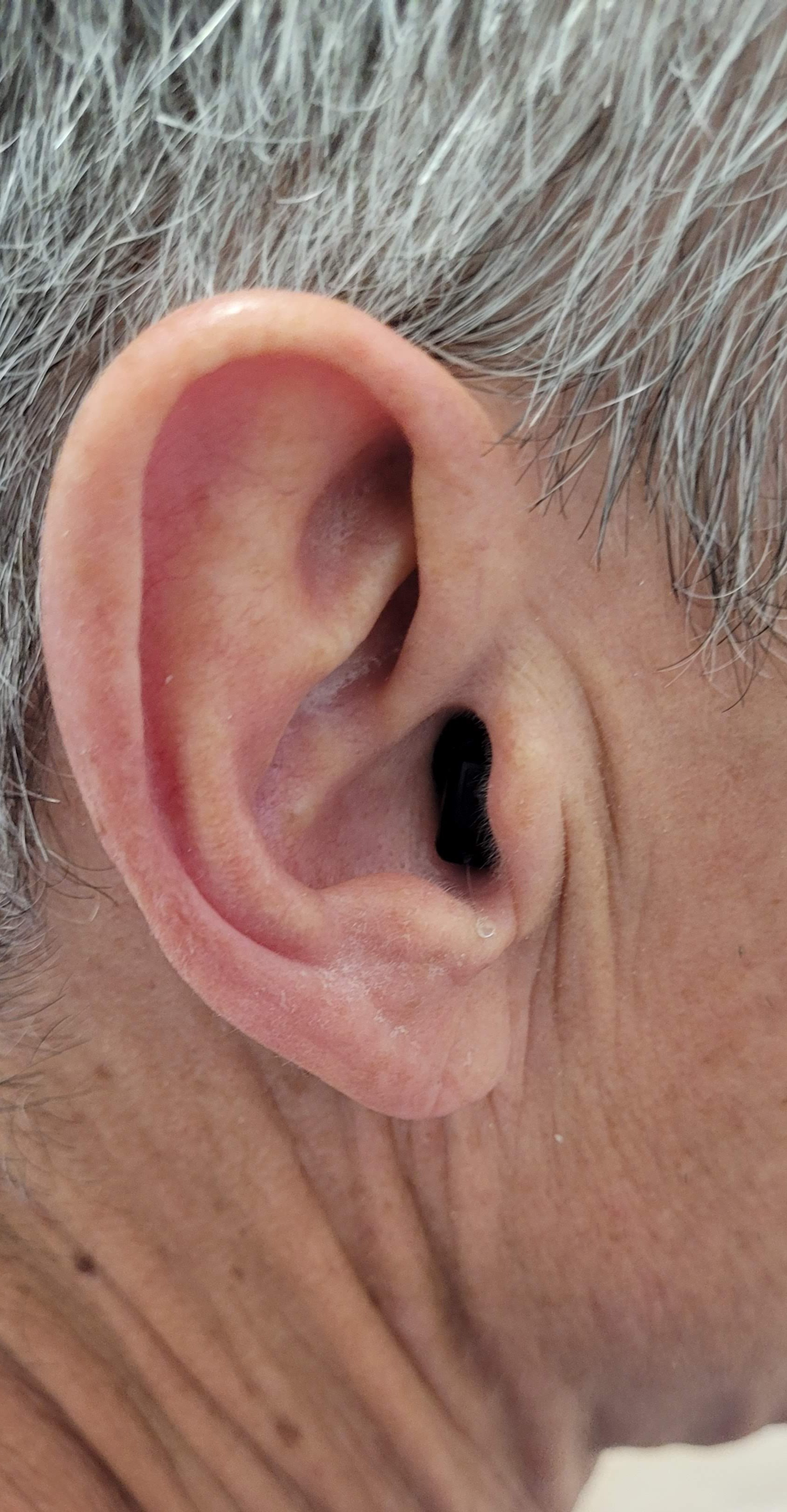 Création Appareils Auditifs Intra-auriculaires visible chez L'AUDIOPROTHESISTE DIMITRI SECONDE